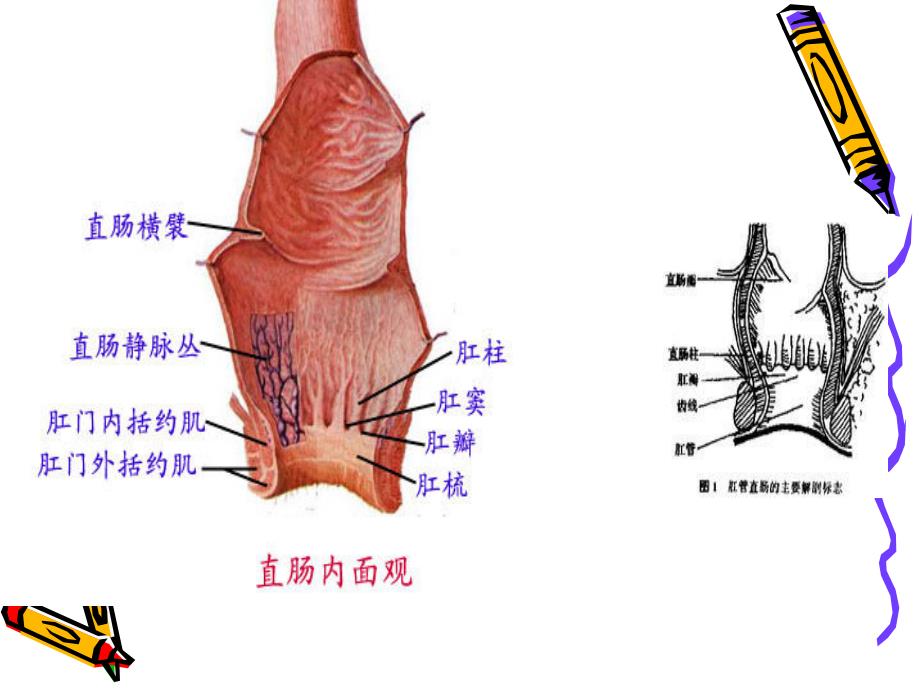 痔疮病人的护理.ppt_第3页