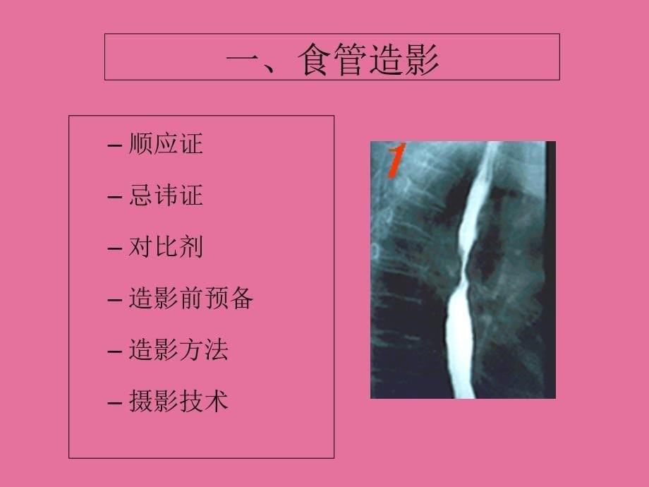 X线造检查ppt课件_第5页