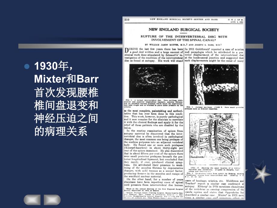 外科学教学课件：腰椎间盘突出症_第3页