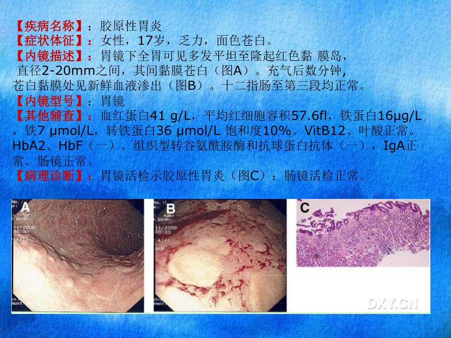 《消化内镜》课件_第1页