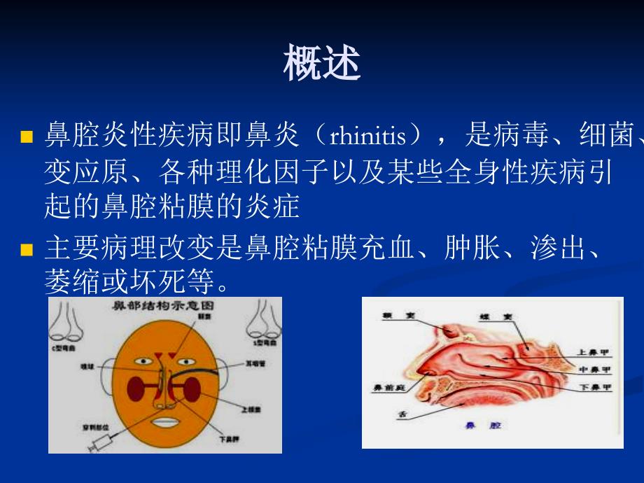 鼻腔炎性疾病_第2页