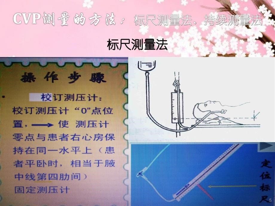 中心静脉压的测量PPT参考课件_第5页