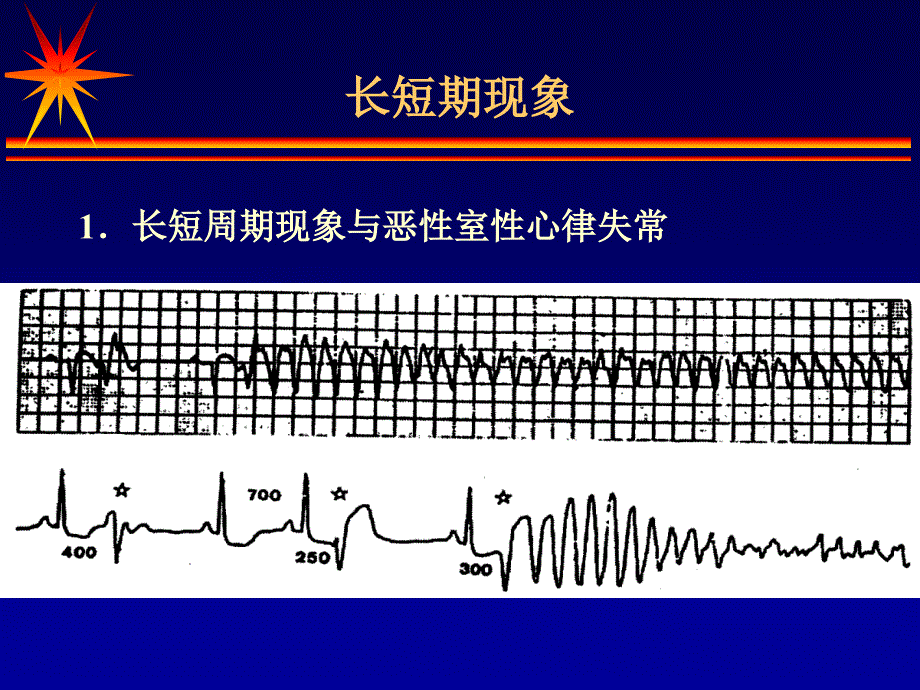 郭继鸿-心律失常心电图的几个特殊现象_第3页