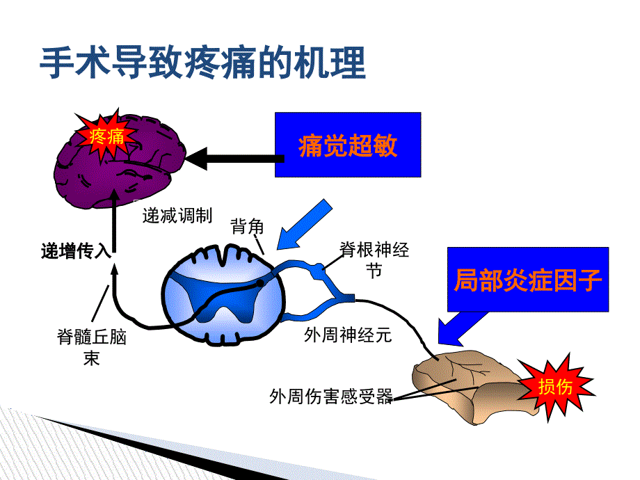 围手术期疼痛管理_第3页