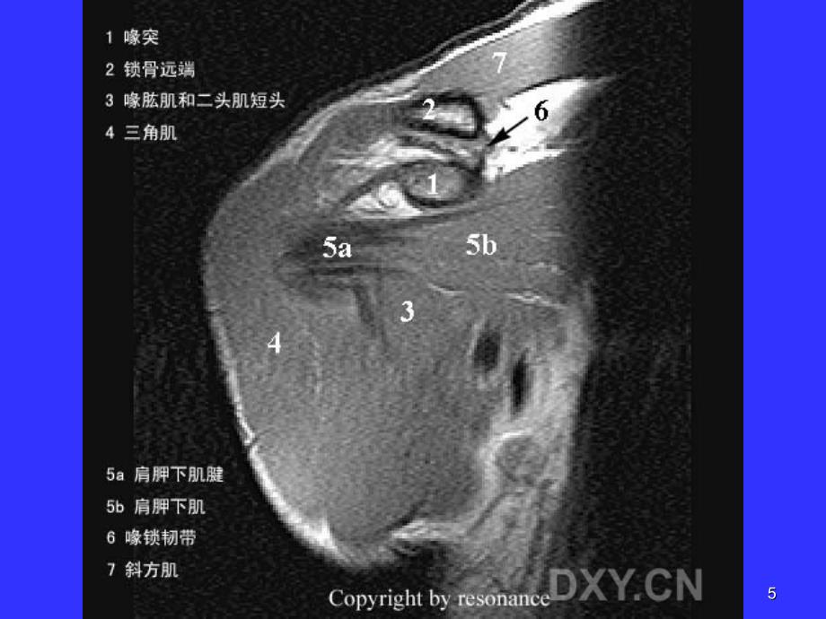 正常肩关节MR表现优秀课件_第5页