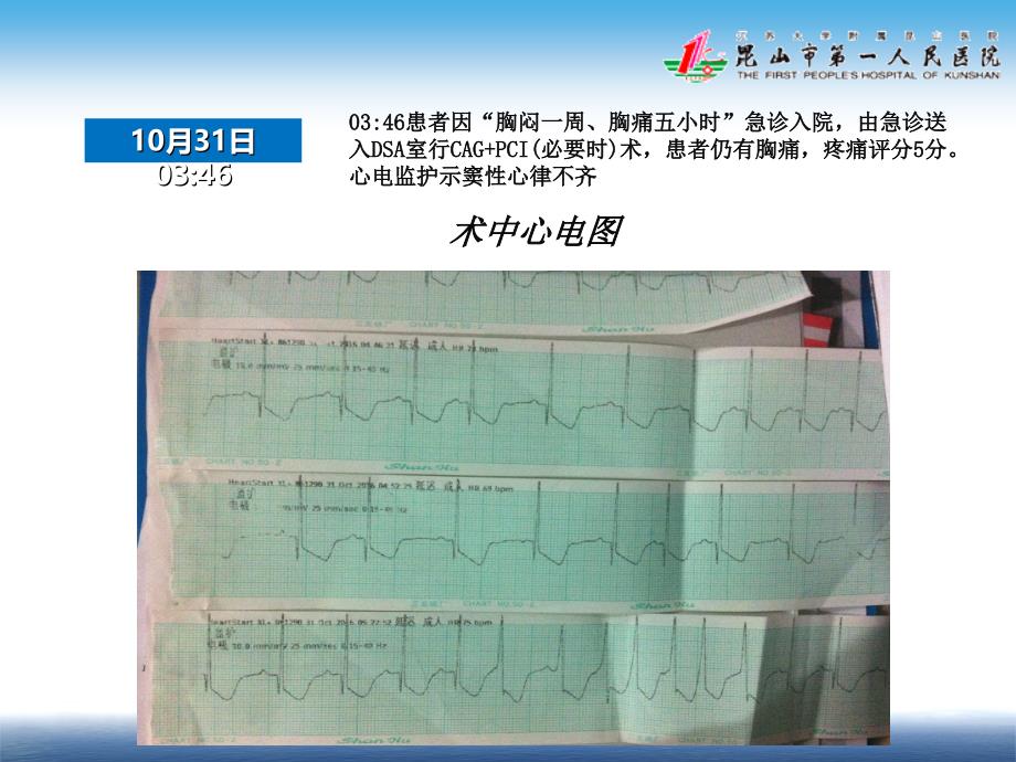 一例心梗病例讨论_第4页