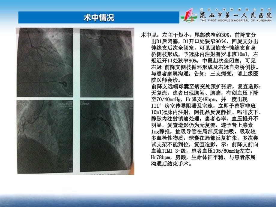 一例心梗病例讨论_第5页