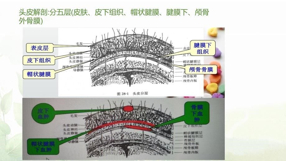 头皮损伤患者的护理.ppt_第5页