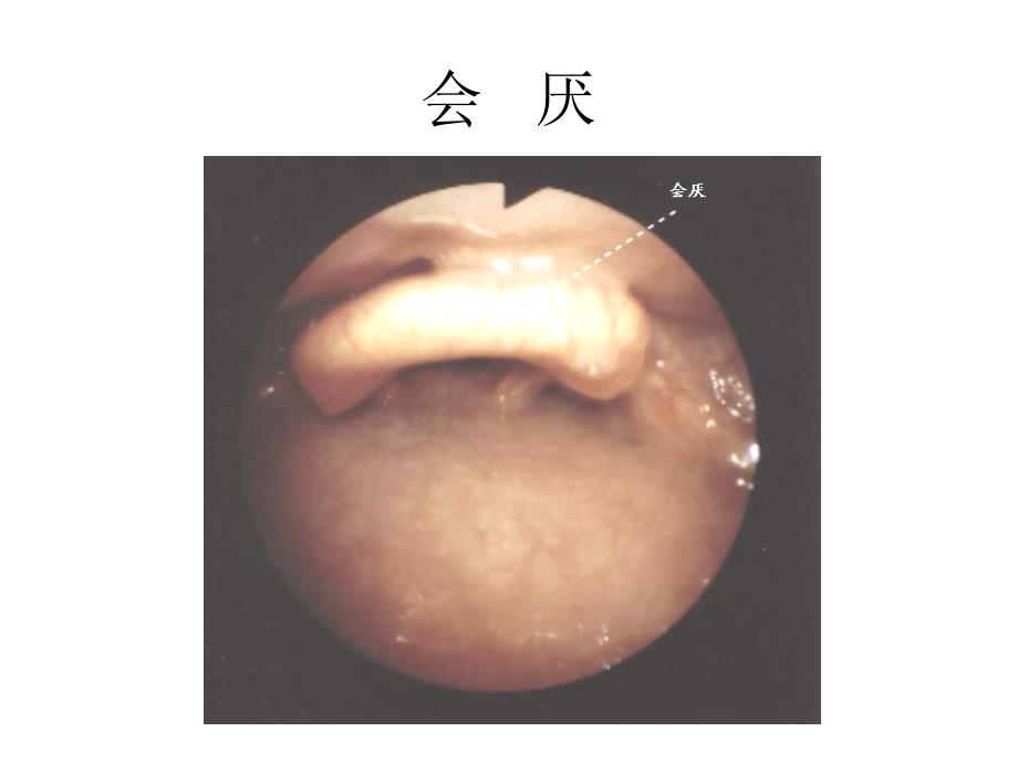 纤维支气管镜解剖_第1页