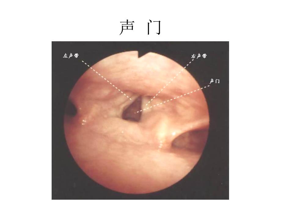 纤维支气管镜解剖_第2页