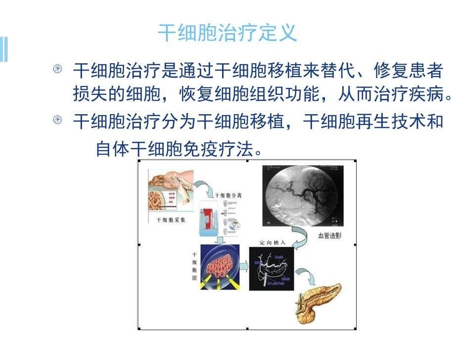 自体干细胞免疫疗法ppt参考课件_第5页