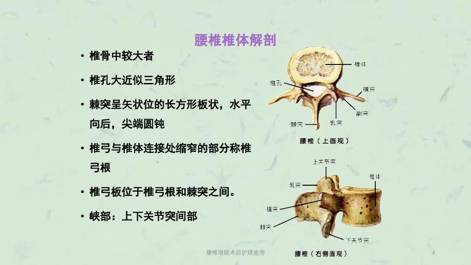 腰椎滑脱术后护理查房课件_第4页