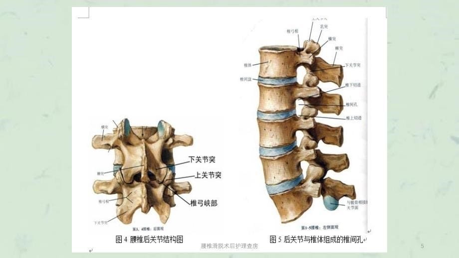 腰椎滑脱术后护理查房课件_第5页