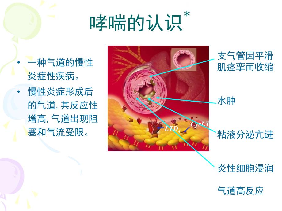 哮喘的诊断及治疗PPT课件_第4页