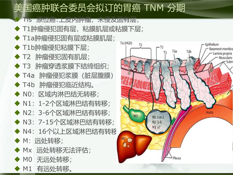 胃癌的TNM分期ppt课件_第4页