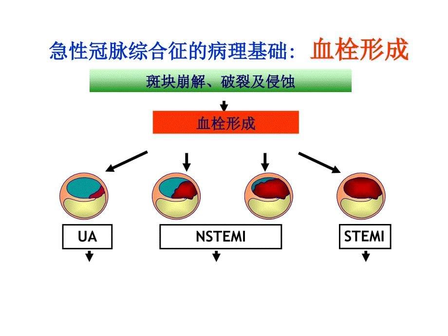 冠心病的治疗新进展PPT课件02_第5页