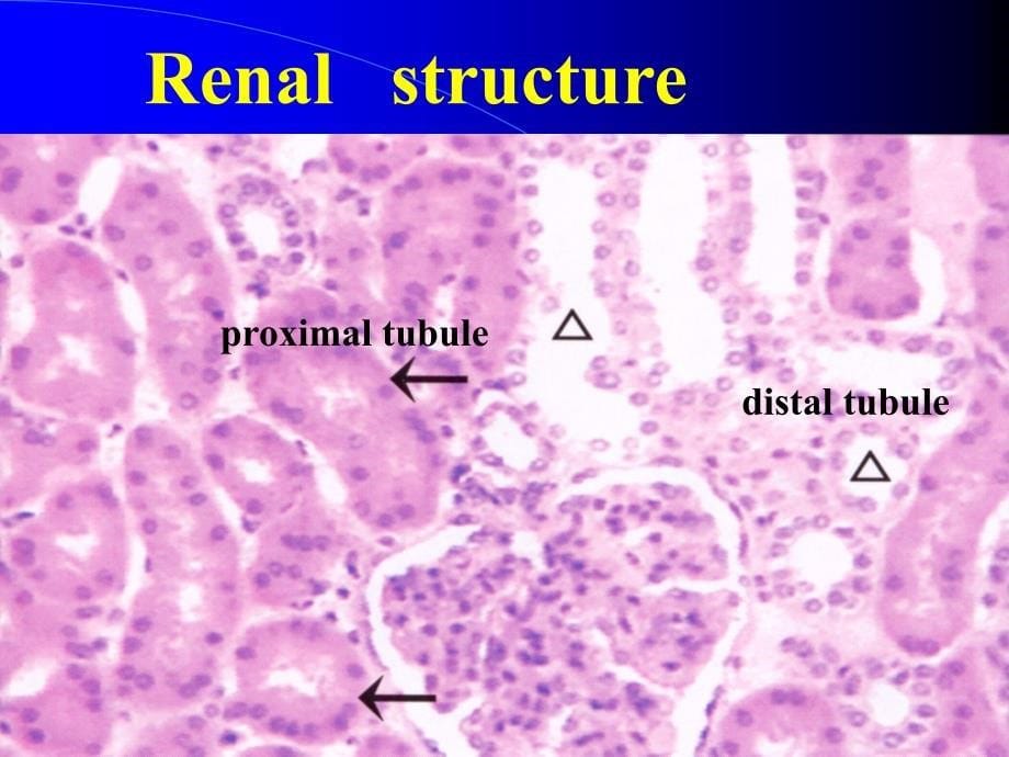 病理学教学课件：e11 Diseases of urinary system1_第5页