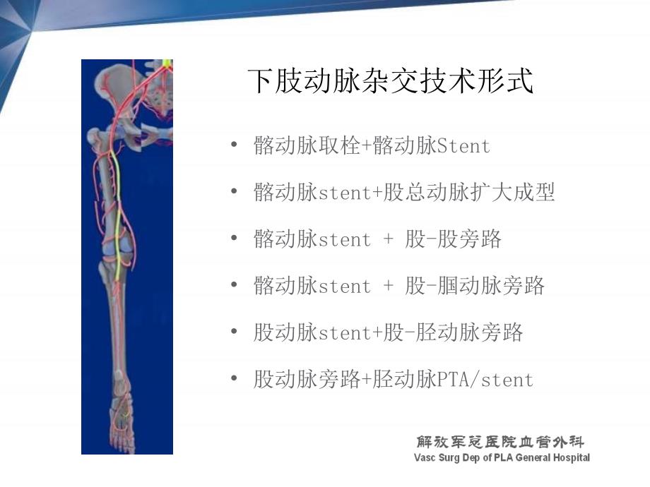 杂交技术在下肢动脉病变中的应用郭伟_第4页