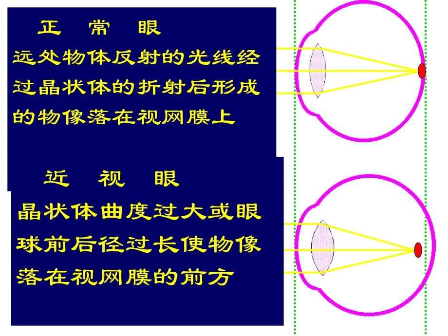 【中小学健康教育课件】人体对外界的感觉—眼和视觉_第5页