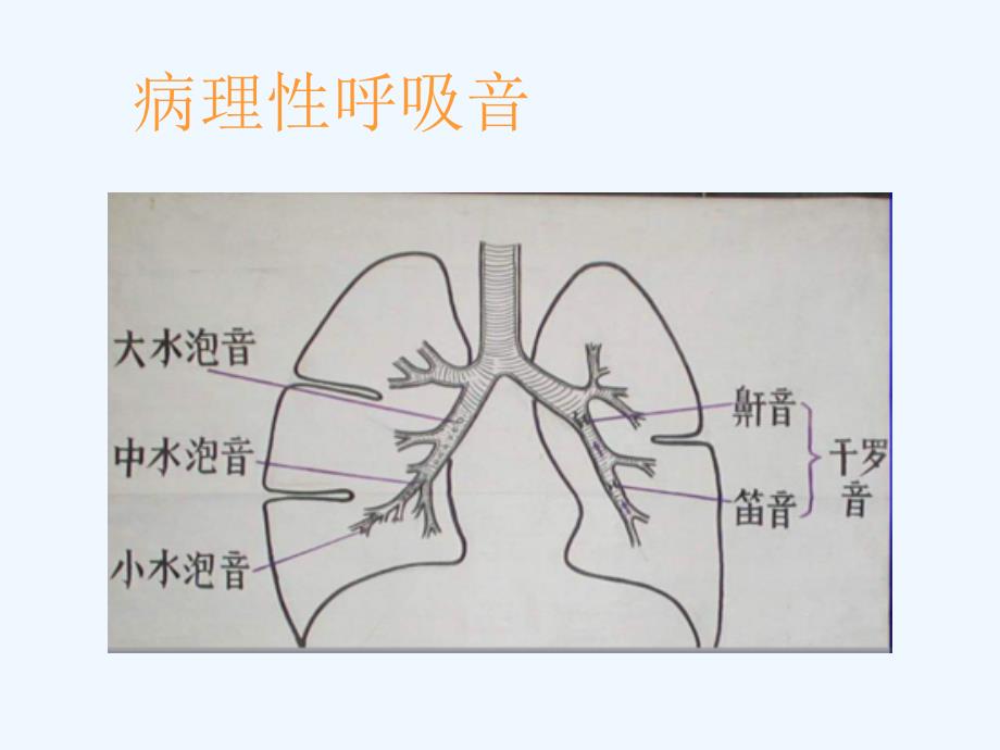 西医诊断-体检-常见疾病的主要症状及体征_第4页