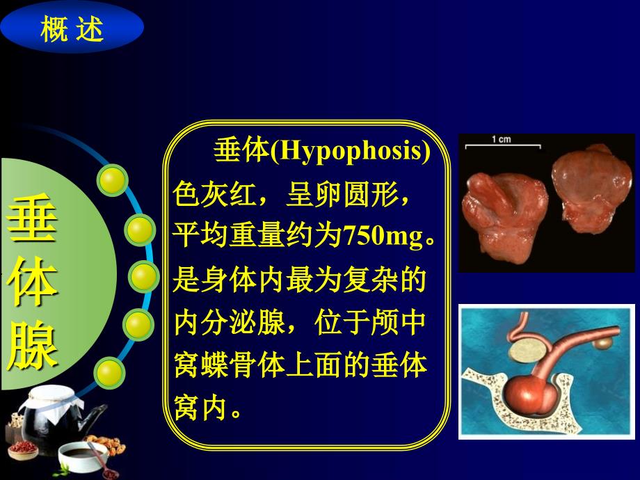 垂体腺瘤的诊断与治疗ppt课件_第4页