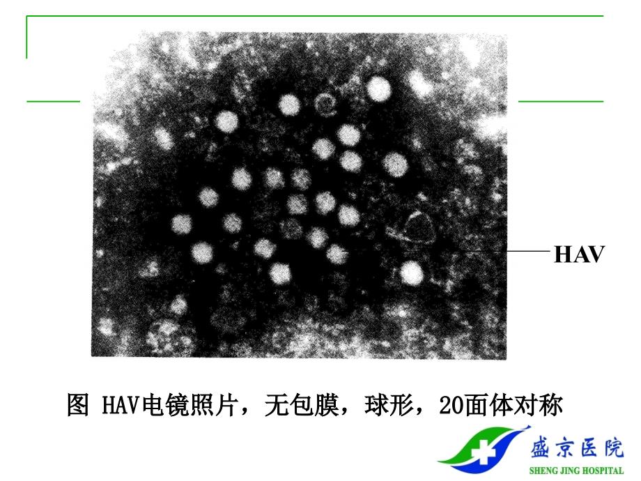 肝炎知识的简介课件_第4页