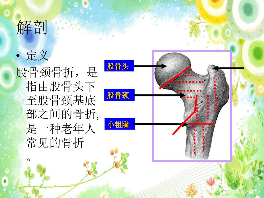 深静脉血栓护理查房_第3页