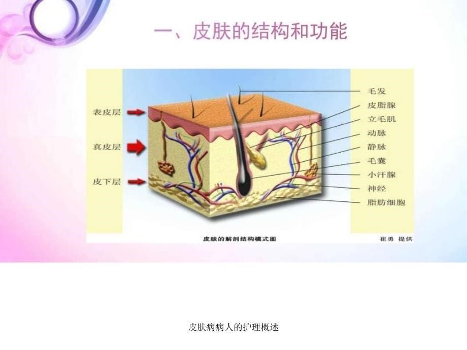 皮肤病病人的护理概述课件_第5页