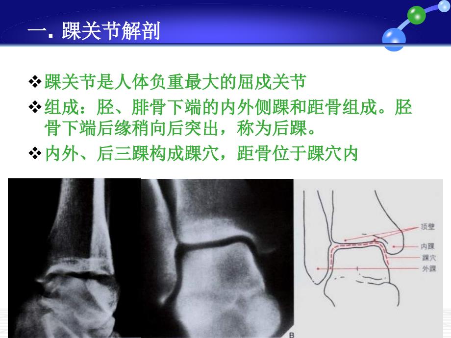 踝关节损伤LaugeHansen分型_第2页