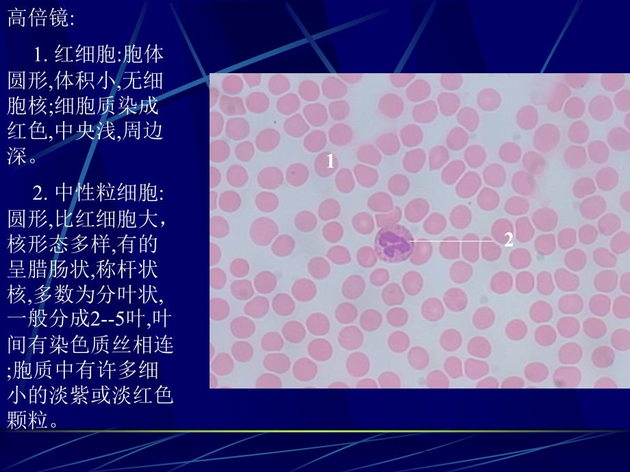 血液和骨髓涂片_第3页