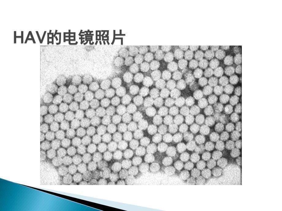 肝炎病毒相关知识讲解_第5页