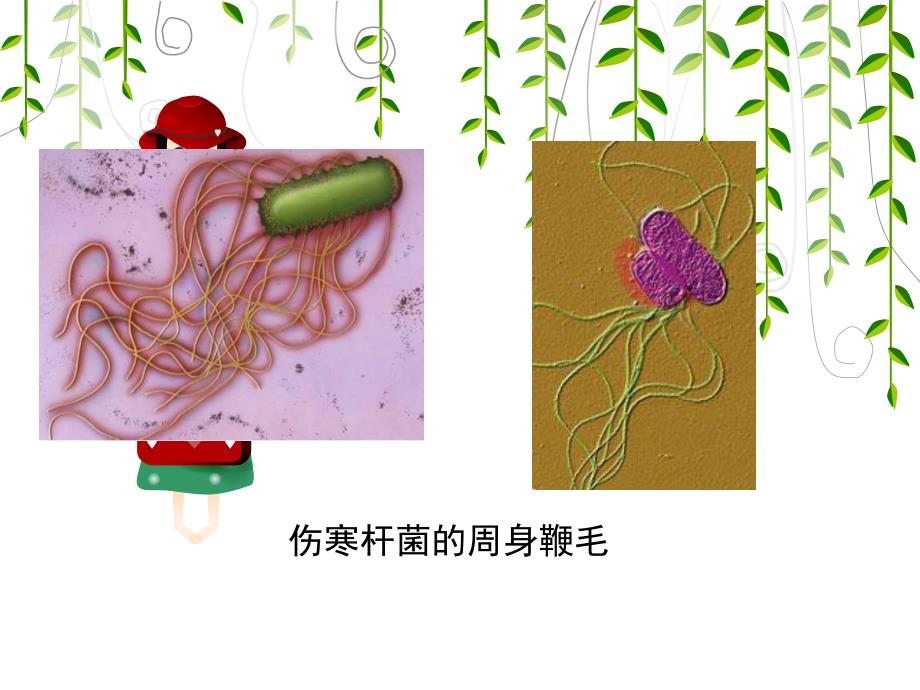 第四节伤寒病人的护理_第4页