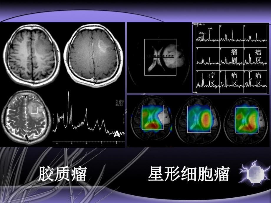 磁共振新进展ppt课件_第5页