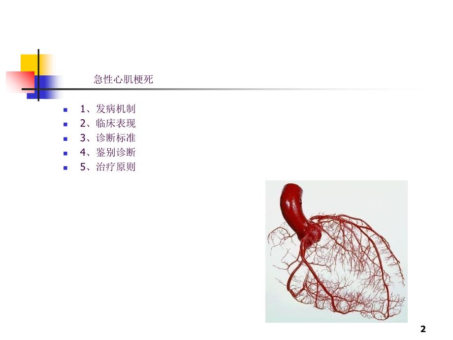 心肌梗死3ppt课件_第2页