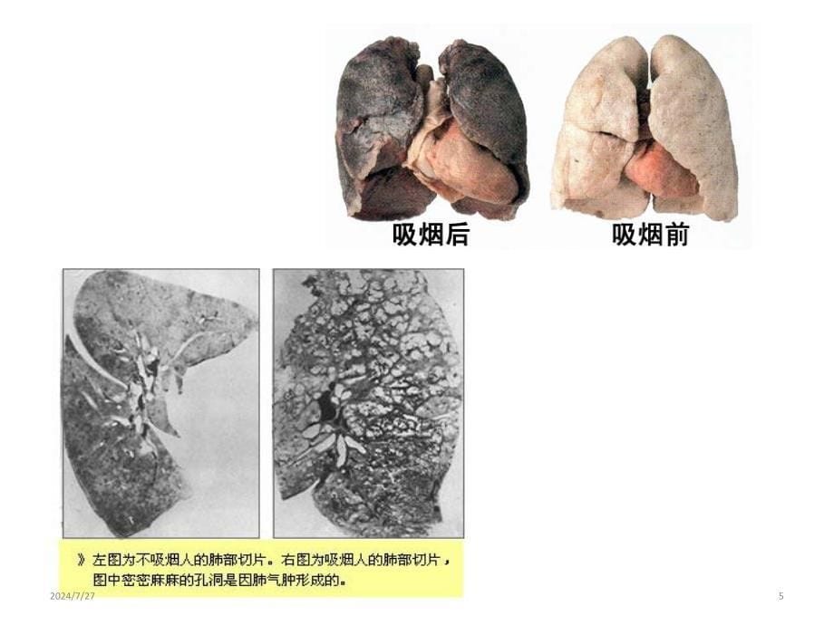 世界无烟日主题班队会(共17张)_第5页