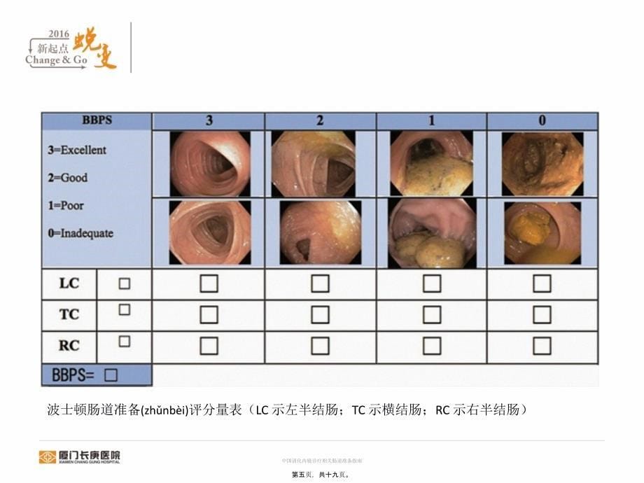 中国消化内镜诊疗相关肠道准备指南课件_第5页