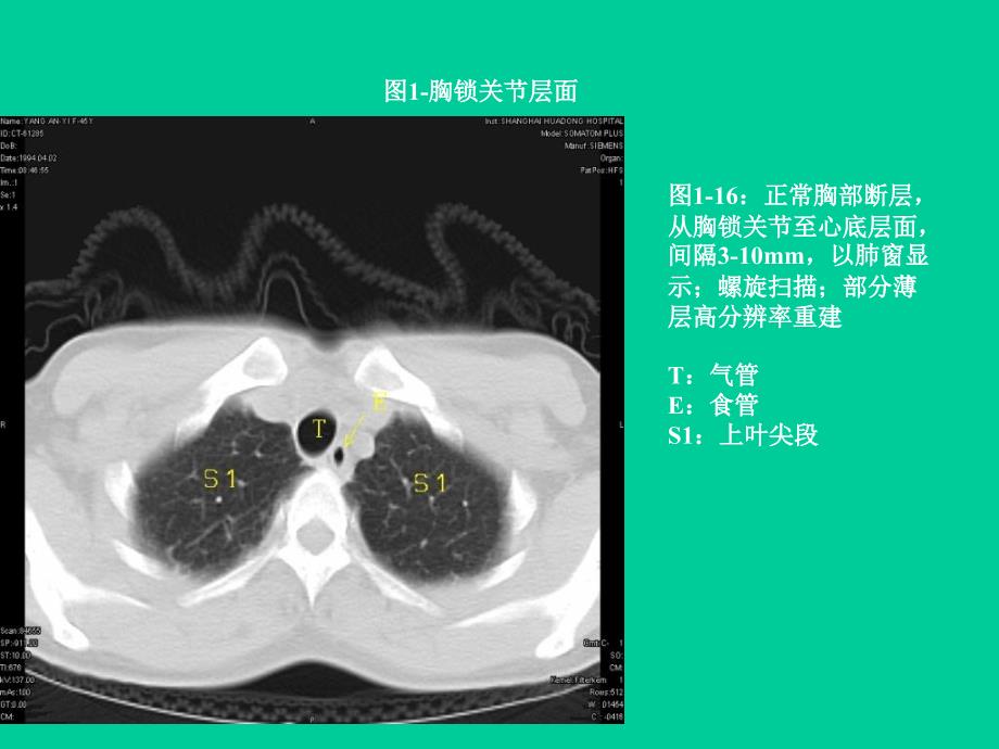 教学幻灯片胸部_第2页