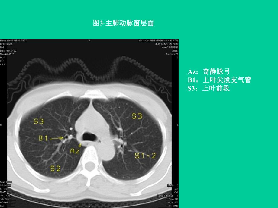 教学幻灯片胸部_第4页