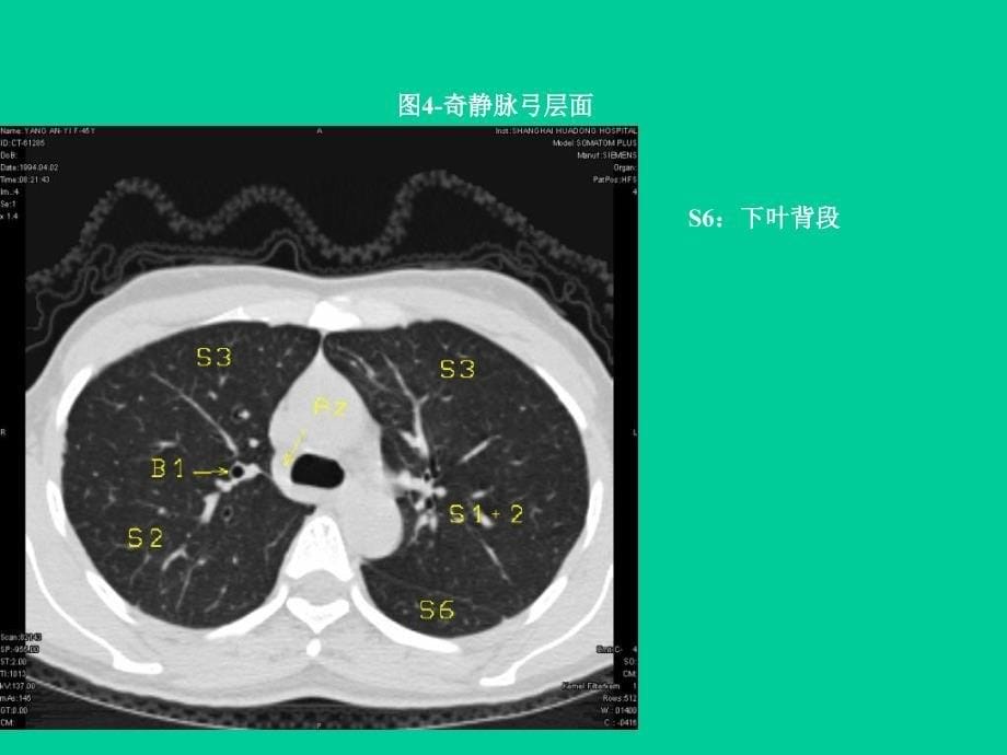 教学幻灯片胸部_第5页