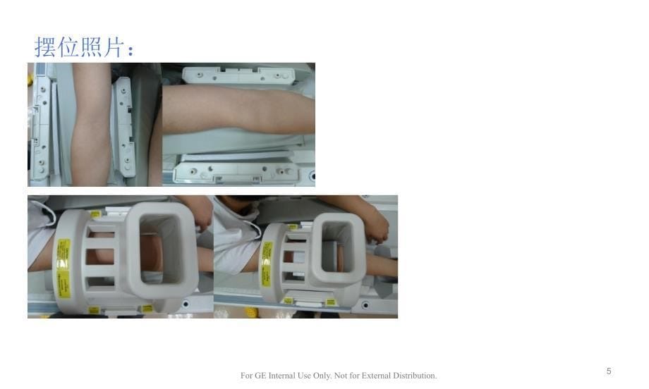 GE_1.5T_MR肘关节规范化扫描方案ppt课件_第5页