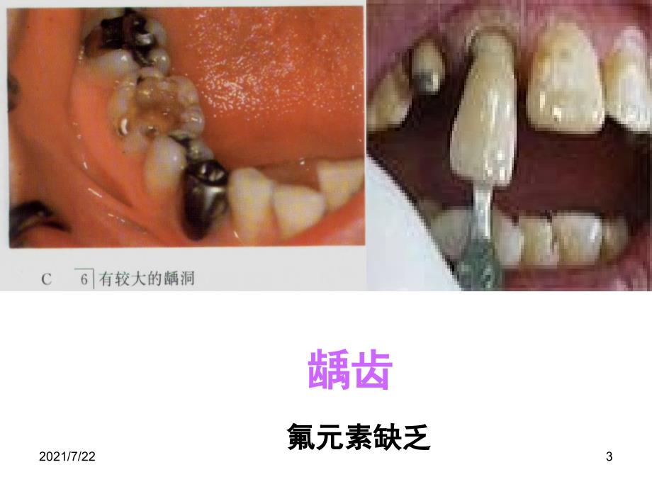 ((人教版))[[初三化学]]初三化学《化学元素与人体健康》PPT课件_第3页