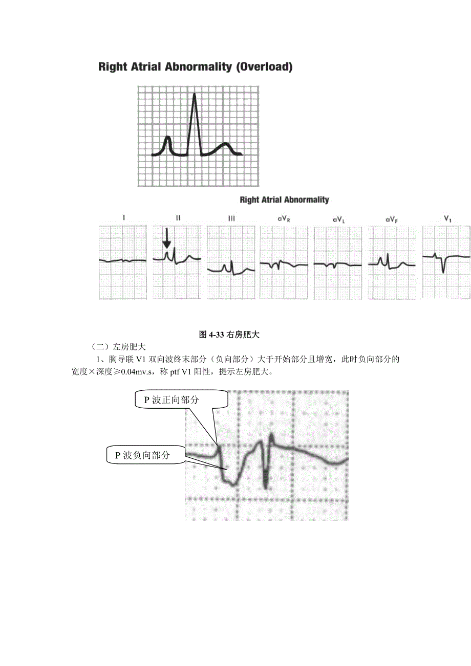 心电图超级学习法4.doc_第4页