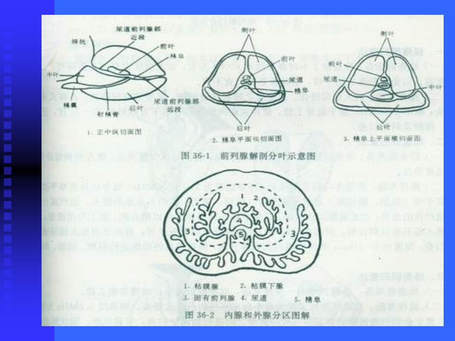 男性科超声诊断学全版PPT课件_第4页