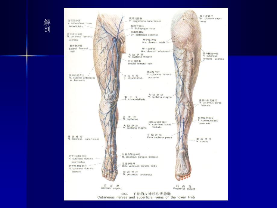 下肢静脉曲张诊治与进展课件_第3页