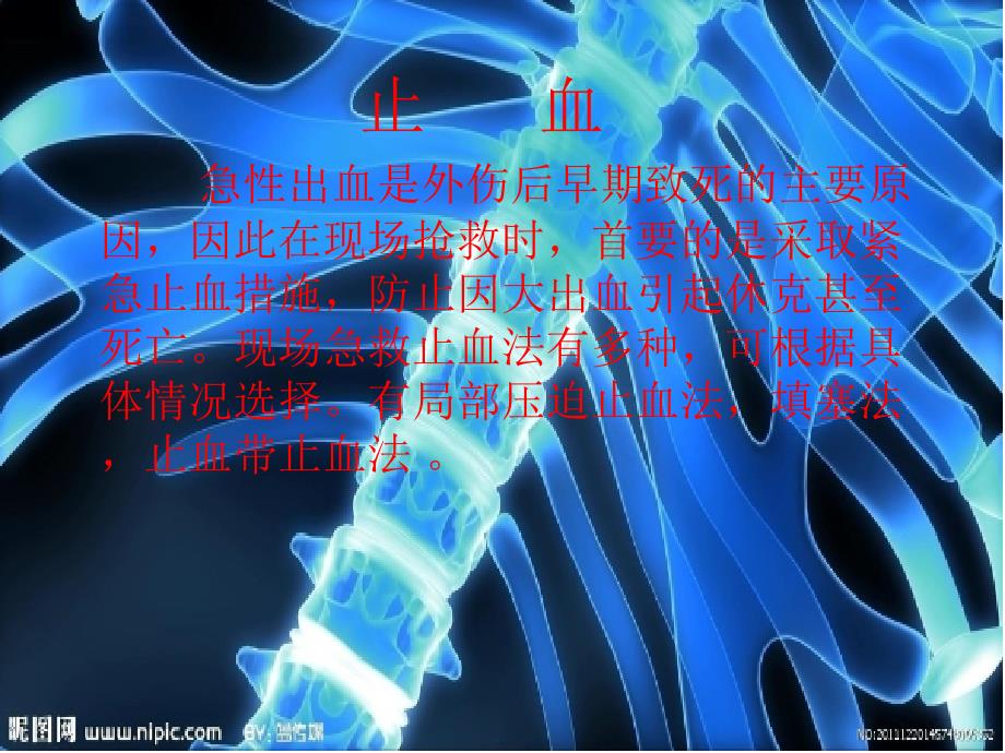 胸部、上肢的包扎_第3页