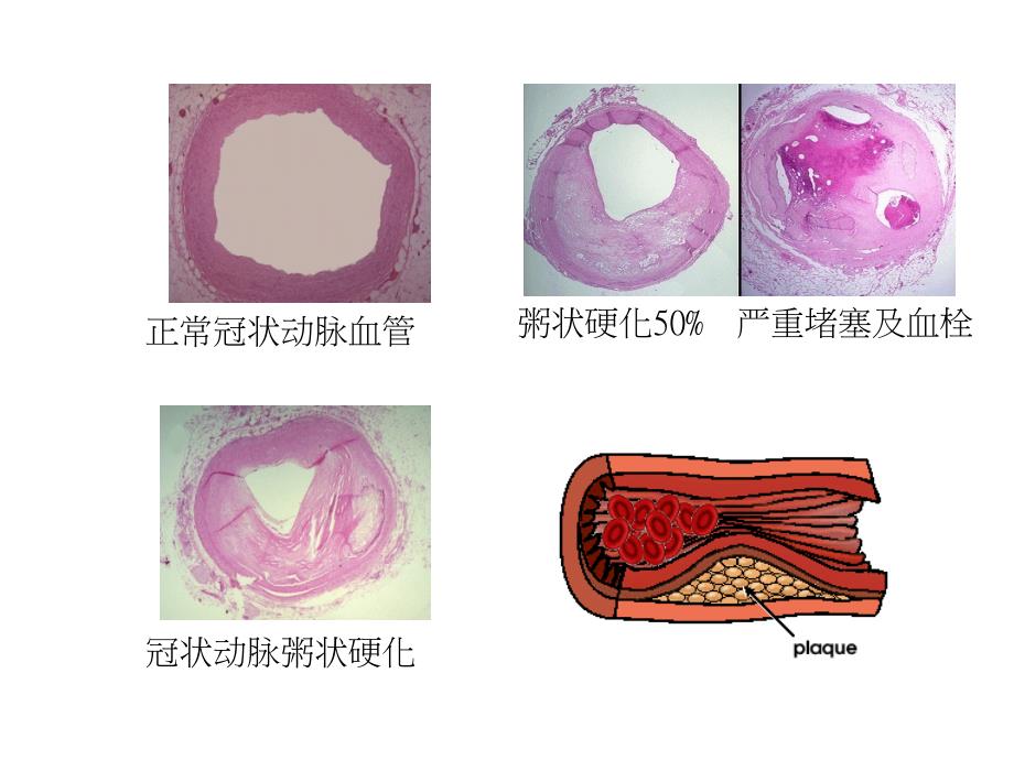 最新心血管保健爱心护心常保健康PPT课件_第2页