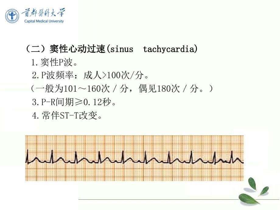 2[1].异常心电图-心律失常_第5页