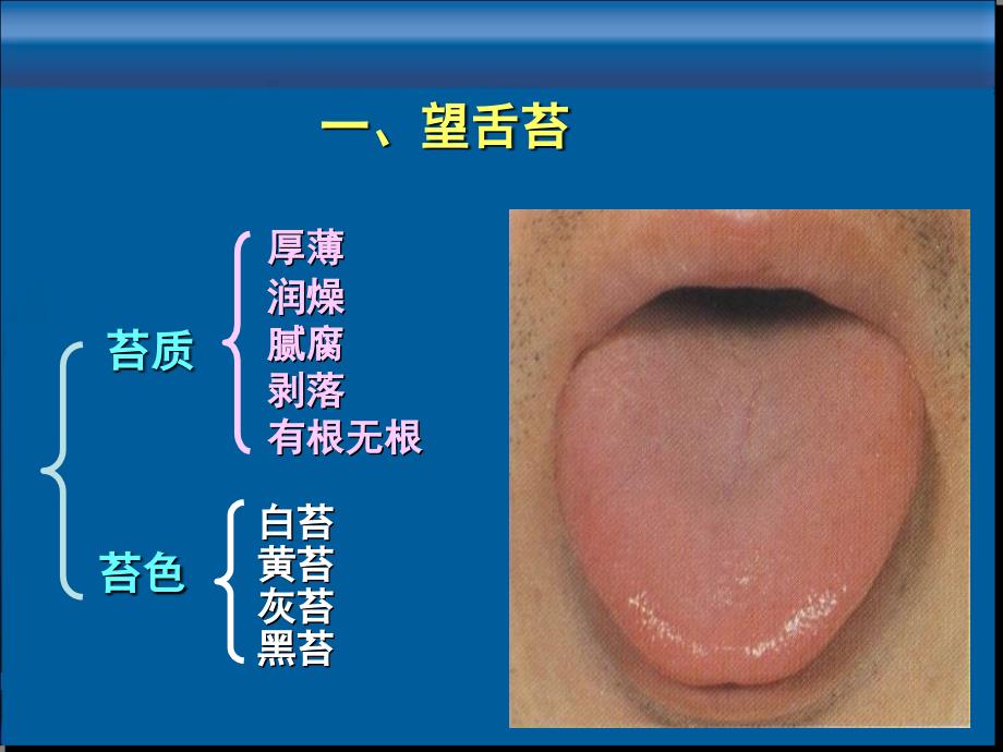 中医诊断-望舌苔_第2页