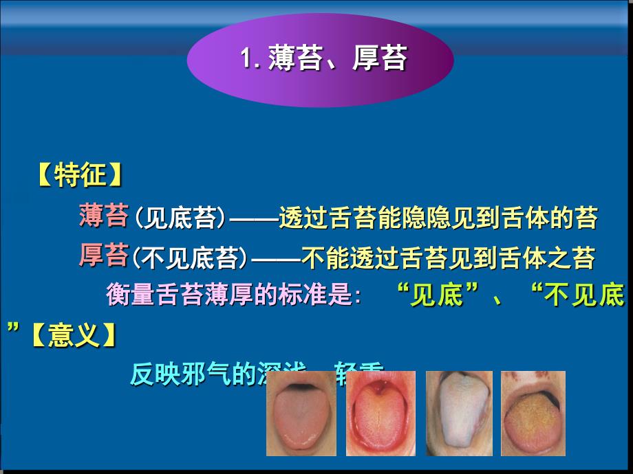 中医诊断-望舌苔_第3页