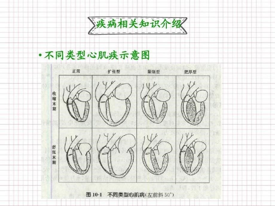 扩张型心肌病的护理ppt课件_第5页